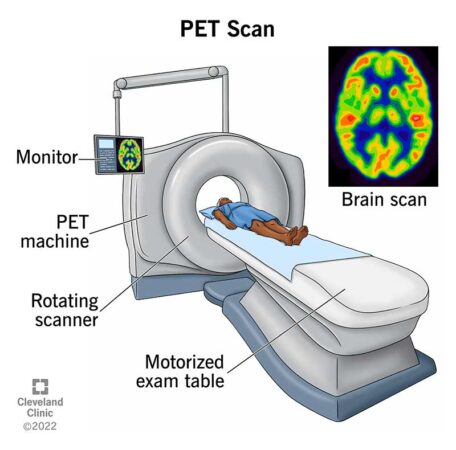 Cost of pet scan without insurance in australia