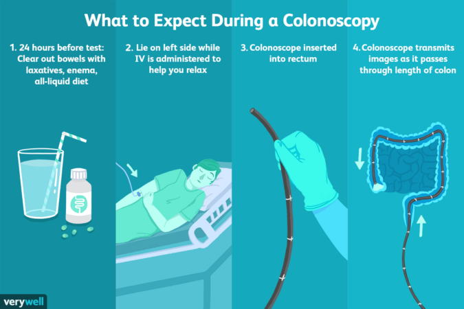 Colonoscopy procedures exams digestive insurance