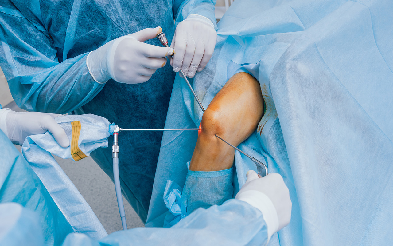 Arthroscopic knee surgery cost without insurance in australia