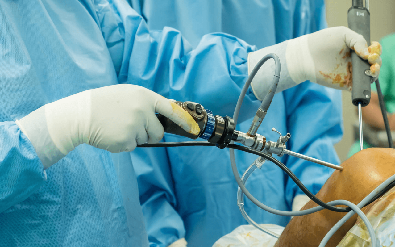 Arthroscopic knee surgery cost without insurance in australia